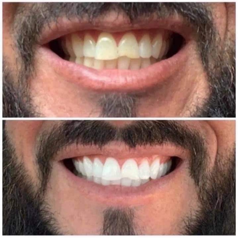 Toothpaste - Picture 3 of 3
